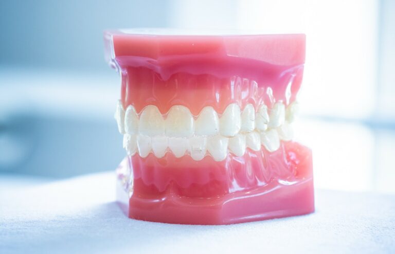 Invisalign Livingston, NJ